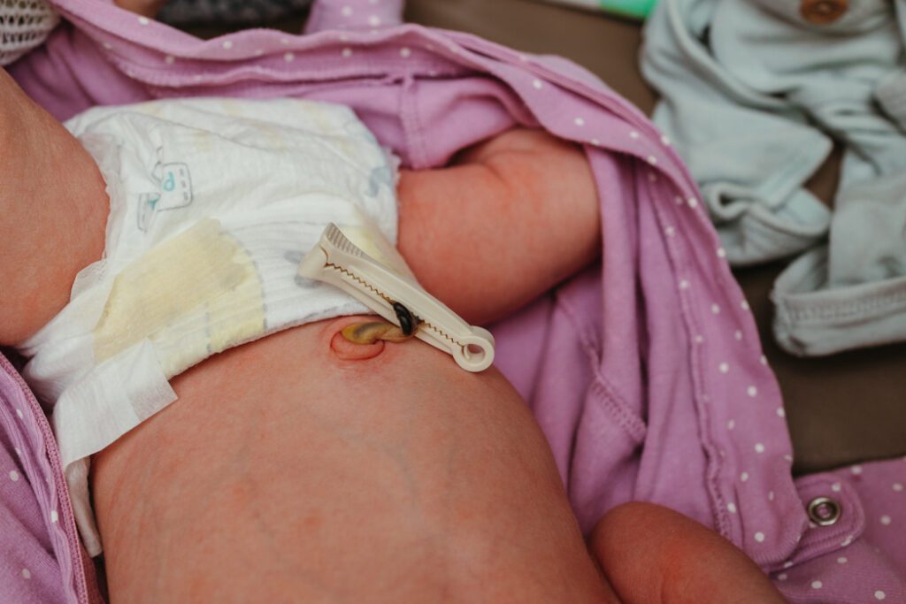 baby umbilical cord during a changing during hospital fresh 48 newborn session